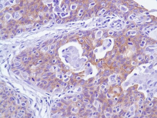 Immunohistochemistry (Formalin/PFA-fixed paraffin-embedded sections) - Anti-delta 1 Catenin/CAS antibody [SP63] - C-terminal (AB227638), expandable thumbnail