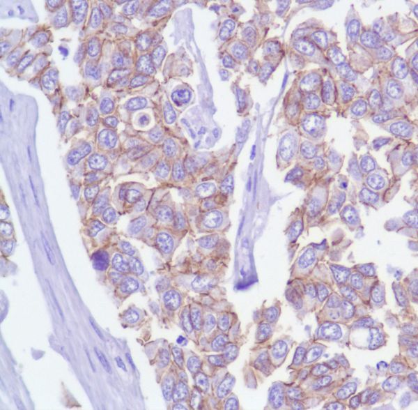 Immunohistochemistry (Formalin/PFA-fixed paraffin-embedded sections) - Anti-delta 1 Catenin/CAS antibody [SP63] - C-terminal (AB227638), expandable thumbnail