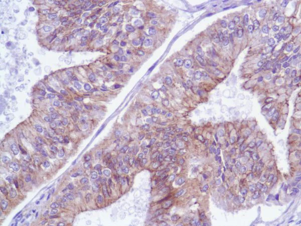 Immunohistochemistry (Formalin/PFA-fixed paraffin-embedded sections) - Anti-delta 1 Catenin/CAS antibody [SP63] - C-terminal (AB227638)