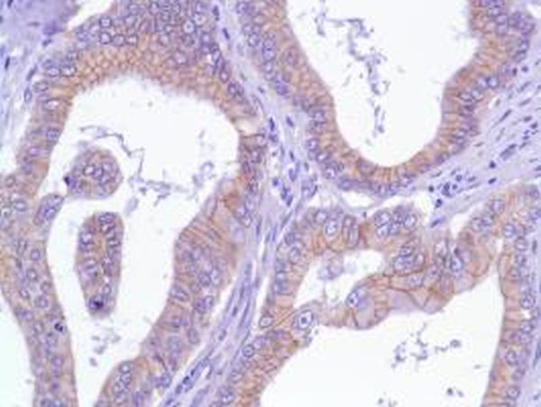 Immunohistochemistry (Formalin/PFA-fixed paraffin-embedded sections) - Anti-delta 1 Catenin/CAS antibody [SP63] - C-terminal (ab227638), expandable thumbnail