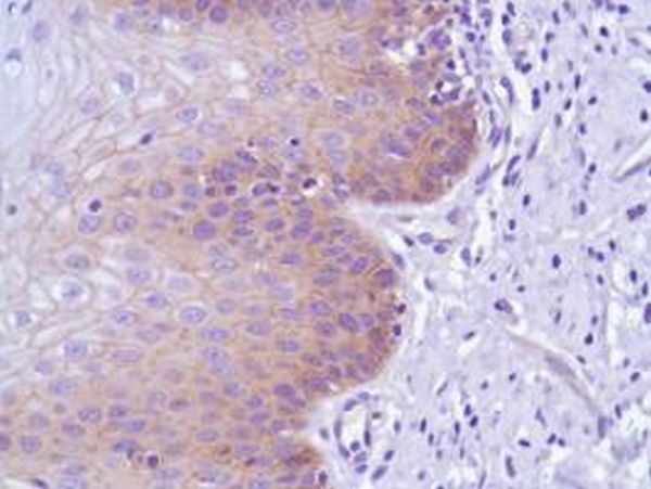 Immunohistochemistry (Formalin/PFA-fixed paraffin-embedded sections) - Anti-delta 1 Catenin/CAS antibody [SP63] - C-terminal (ab227638), expandable thumbnail