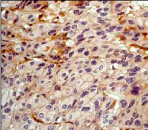 Immunohistochemistry (Formalin/PFA-fixed paraffin-embedded sections) - Anti-delta 1 Catenin/CAS antibody [YE372] (AB32095)