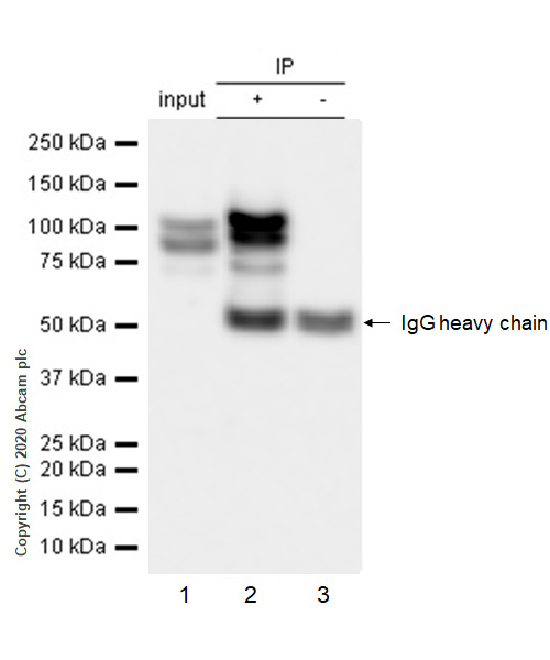 Immunoprecipitation - Anti-delta 1 Catenin/CAS antibody [YE372] (AB32095), expandable thumbnail