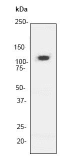 Western blot - Anti-delta 1 Catenin/CAS antibody [YE372] (AB32095), expandable thumbnail