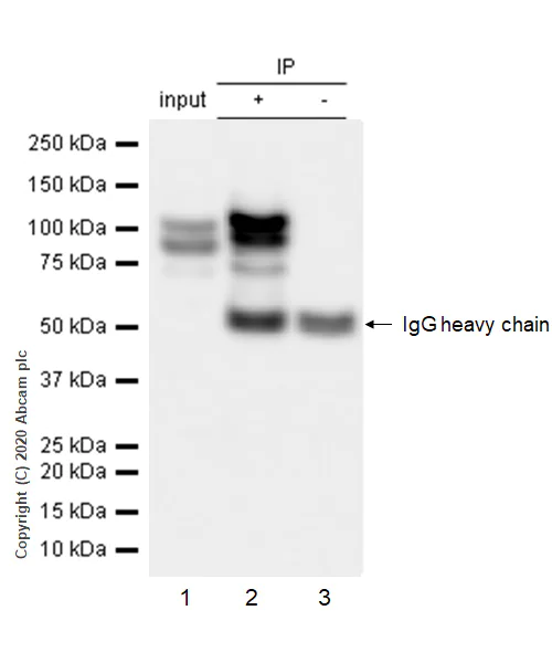 Immunoprecipitation - Anti-delta 1 Catenin/CAS antibody [YE372] - BSA and Azide free (AB247228)