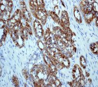Immunohistochemistry (Formalin/PFA-fixed paraffin-embedded sections) - Anti-delta 1 Catenin/CAS (phospho S268) antibody [EPR2380] (AB79545)