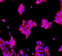Immunocytochemistry/ Immunofluorescence - Anti-delta 1 Catenin/CAS (phospho S268) antibody [EPR2380] - BSA and Azide free (AB247506)