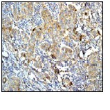 Immunohistochemistry (Formalin/PFA-fixed paraffin-embedded sections) - Anti-delta 1 Catenin/CAS (phospho T310) antibody [EPR2382] (AB81318)