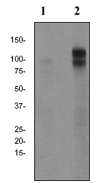 Western blot - Anti-delta 1 Catenin/CAS (phospho T310) antibody [EPR2382] (AB81318)