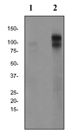 Western blot - Anti-delta 1 Catenin/CAS (phospho T310) antibody [EPR2382] (AB81318)