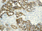Immunohistochemistry (Formalin/PFA-fixed paraffin-embedded sections) - Anti-delta 1 Catenin/CAS (phospho T916) antibody [EPR2383] (AB79400)