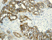 Immunohistochemistry (Formalin/PFA-fixed paraffin-embedded sections) - Anti-delta 1 Catenin/CAS (phospho T916) antibody [EPR2383] - BSA and Azide free (AB247498), expandable thumbnail