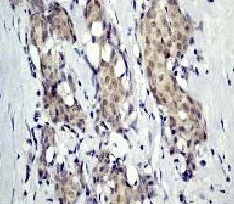 Immunohistochemistry (Formalin/PFA-fixed paraffin-embedded sections) - Anti-delta 1 Catenin/CAS (phospho Y228) antibody [E205] (AB32403)