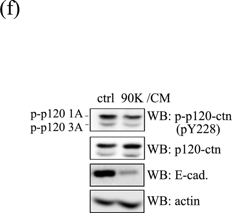 Western blot - Anti-delta 1 Catenin/CAS (phospho Y228) antibody [E205] (AB32403)