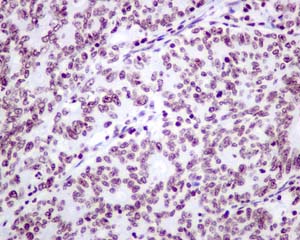 Immunohistochemistry (Formalin/PFA-fixed paraffin-embedded sections) - Anti-delta 1 Catenin/CAS (phospho Y280) antibody [EPR2384(2)] (AB173578)