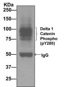 Immunoprecipitation - Anti-delta 1 Catenin/CAS (phospho Y280) antibody [EPR2384(2)] (AB173578)