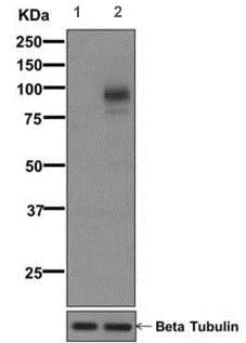 Western blot - Anti-delta 1 Catenin/CAS (phospho Y280) antibody [EPR2384(2)] (AB173578)