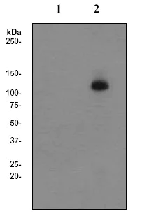 Western blot - Anti-delta 1 Catenin/CAS (phospho Y291) antibody [EP2385Y] - BSA and Azide free (AB284769)
