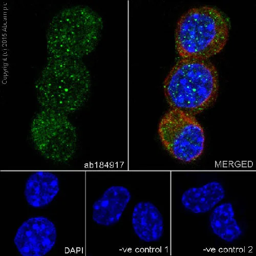 Immunocytochemistry/ Immunofluorescence - Anti-Delta-catenin antibody [EPR17628] (AB184917)