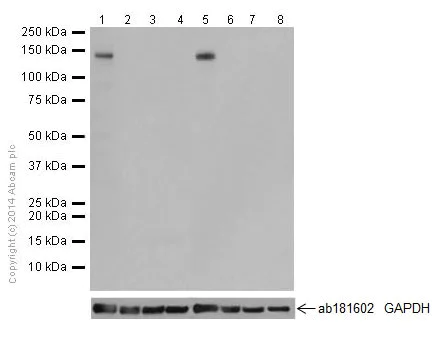 Western blot - Anti-Delta-catenin antibody [EPR17628] - BSA and Azide free (AB250781)