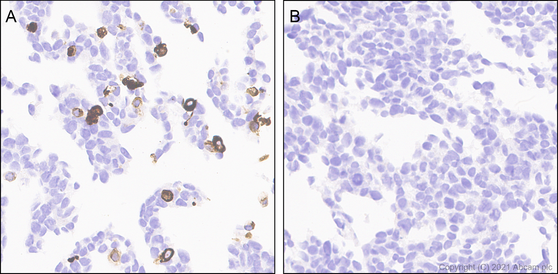 Immunohistochemistry (Formalin/PFA-fixed paraffin-embedded sections) - Anti-Delta Opioid Receptor antibody [EPR24378-193] (AB283692), expandable thumbnail