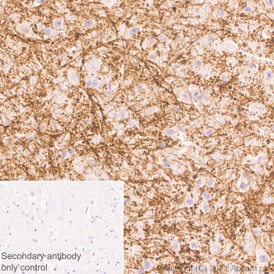 Immunohistochemistry (Formalin/PFA-fixed paraffin-embedded sections) - Anti-Delta Opioid Receptor antibody [EPR24378-193] (AB283692), expandable thumbnail