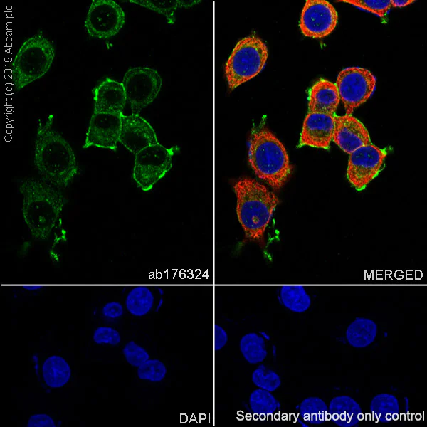 Immunocytochemistry/ Immunofluorescence - Anti-Delta Opioid Receptor antibody [EPR5029(2)] (AB176324)