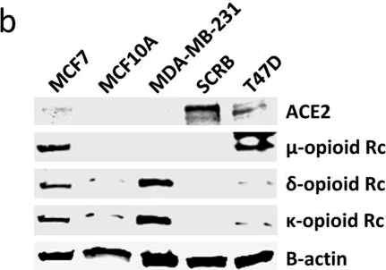 Western blot - Anti-Delta Opioid Receptor antibody [EPR5029(2)] (AB176324)