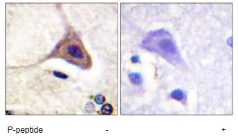 Immunohistochemistry (Formalin/PFA-fixed paraffin-embedded sections) - Anti-Delta Opioid Receptor (phospho S363) antibody (AB62152)