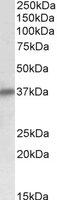 Western blot - Anti-delta Sarcoglycan antibody (AB115019)