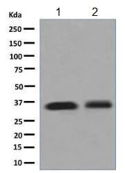 Western blot - Anti-delta Sarcoglycan antibody [EPR8706] (AB137101)