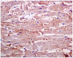 Immunohistochemistry (Formalin/PFA-fixed paraffin-embedded sections) - Anti-delta Sarcoglycan antibody [EPR8706] - BSA and Azide free (AB240108)