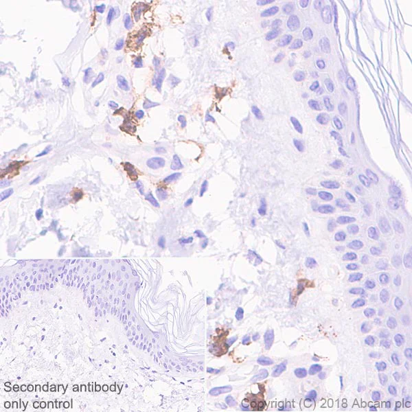 Immunohistochemistry (Formalin/PFA-fixed paraffin-embedded sections) - Dendritic Cell Marker (CD103, LY75/DEC-205, TLR7, DC-SIGN + DC-SIGNR) Antibody Panel - Human (AB254017)