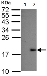 Western blot - Anti-Dengue Virus 2 antibody (AB155042), expandable thumbnail