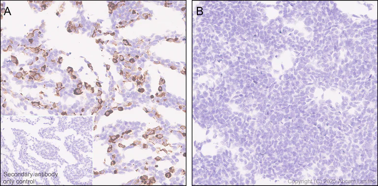 Immunohistochemistry (Formalin/PFA-fixed paraffin-embedded sections) - Anti-Dengue Virus 2 envelope glycoprotein antibody [EPR30748-587] (AB325012)