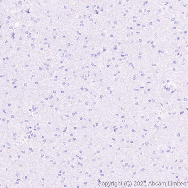 Immunohistochemistry (Formalin/PFA-fixed paraffin-embedded sections) - Anti-Dengue Virus 2 envelope glycoprotein antibody [EPR30748-587] (AB325012)