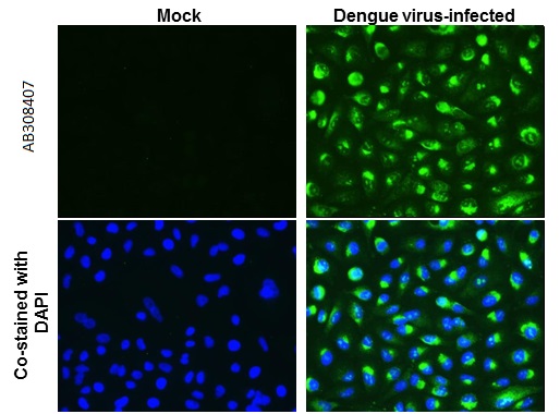Immunocytochemistry/ Immunofluorescence - Anti-Dengue virus Capsid protein antibody [GT574] - BSA and Azide free (AB308407), expandable thumbnail