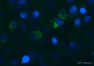 Immunocytochemistry/ Immunofluorescence - Anti-Dengue Virus NS1 glycoprotein antibody [DN2] (AB41623)