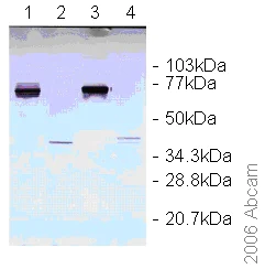 Western blot - Anti-Dengue Virus NS1 glycoprotein antibody [DN2] (AB41623)