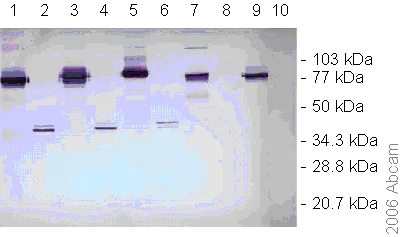Western blot - Anti-Dengue Virus NS1 glycoprotein antibody [DN3] (AB41616)