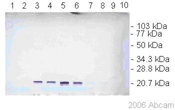 Western blot - Anti-Dengue Virus prM glycoprotein antibody [DM1] (AB41473)