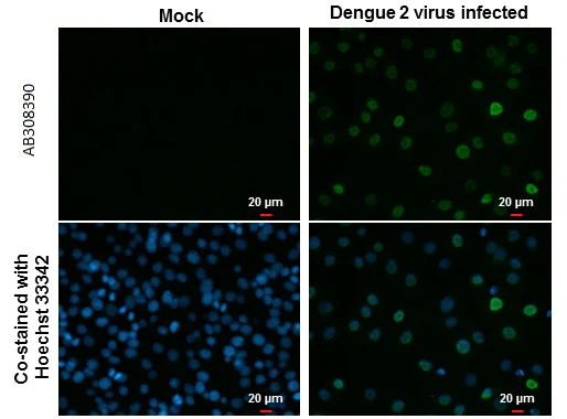 Immunocytochemistry/ Immunofluorescence - Anti-Dengue virus Type 2 NS5 protein antibody [GT361] (AB308390)