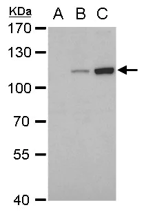 Western blot - Anti-Dengue virus Type 2 NS5 protein antibody [GT361] (AB308390)
