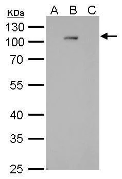 Western blot - Anti-Dengue virus Type 2 NS5 protein antibody [GT361] (AB308390)
