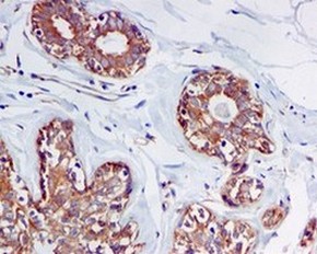 Immunohistochemistry (Formalin/PFA-fixed paraffin-embedded sections) - Anti-DENN antibody [EPR4919] (AB134117), expandable thumbnail