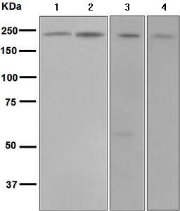 Western blot - Anti-DENN antibody [EPR4919] (AB134117), expandable thumbnail