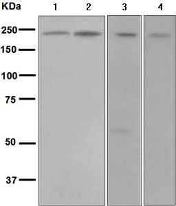 Western blot - Anti-DENN antibody [EPR4919] (AB134117)