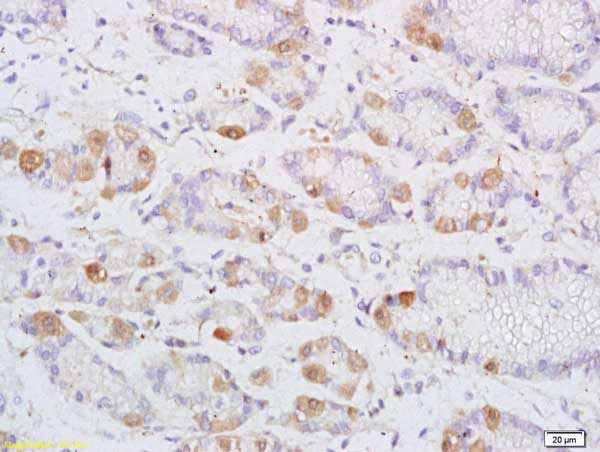 Immunohistochemistry (Formalin/PFA-fixed paraffin-embedded sections) - Anti-DENND2D antibody (AB217921)
