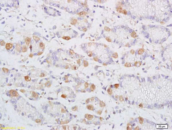 Immunohistochemistry (Formalin/PFA-fixed paraffin-embedded sections) - Anti-DENND2D antibody (AB217921)