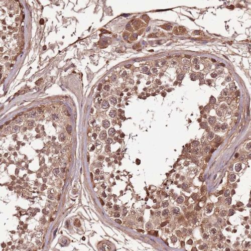 Immunohistochemistry (Formalin/PFA-fixed paraffin-embedded sections) - Anti-Density Regulated Protein antibody (AB244388)